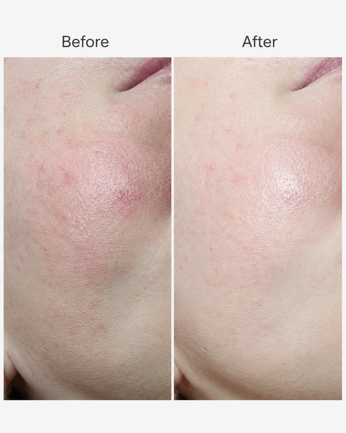 Panthenol for Oily Skin: Why Hydration Still Matters